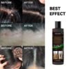Tinea Capitis Anti-Itch Shampoo Anti-Drop Refreshing Oil Control Hair Care Anti-Dandruff Anti-Itch Shampoo