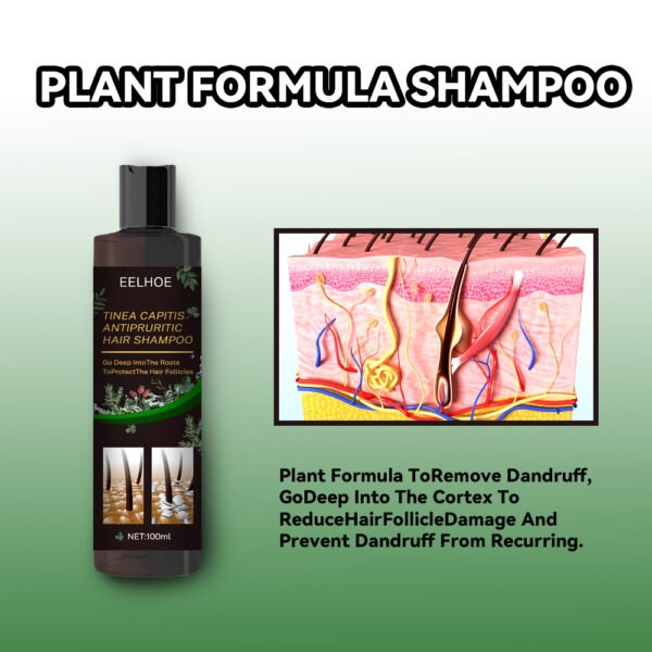 Tinea Capitis Anti-Itch Shampoo Anti-Drop Refreshing Oil Control Hair Care Anti-Dandruff Anti-Itch Shampoo