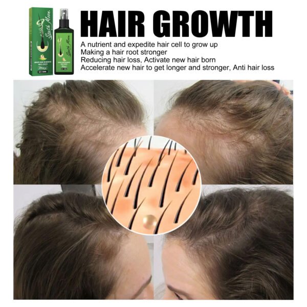 Hair Care Spray Nourishing And Nourishing Hair Massage Repair Hair And Scalp Care Solution