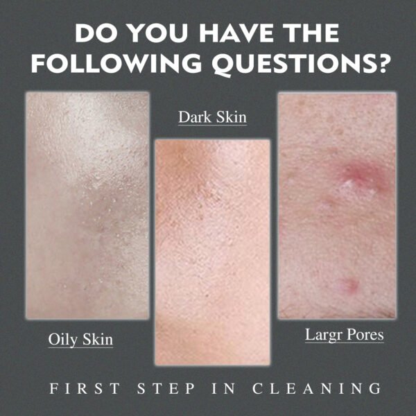 Men's Amino Acid Oil Control Face Wash, Deep Clean Acne Print Delicate Pores Whitening Brightening Skin